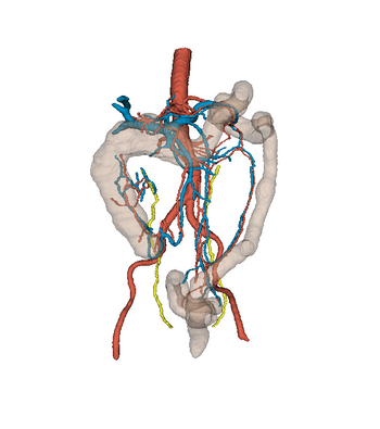 SurgicalVision 3D