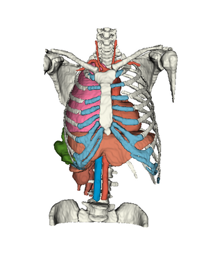 SurgicalVision 3D