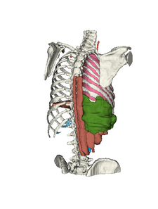 SurgicalVision 3D